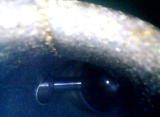 利用HIE系列內窺鏡檢測到的某4s店發(fā)動機進氣道圖片